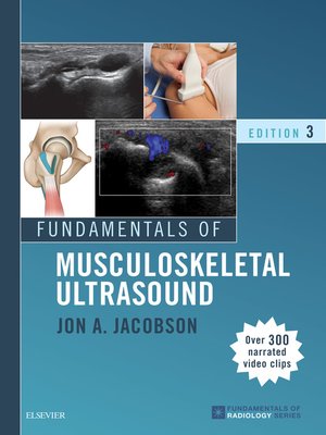cover image of Fundamentals of Musculoskeletal Ultrasound